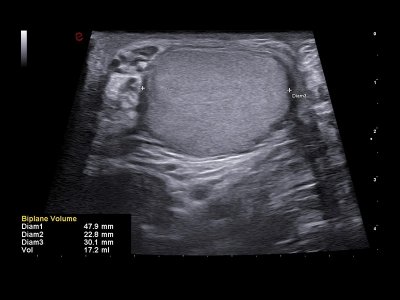 Intervencijsko B Mode Testis