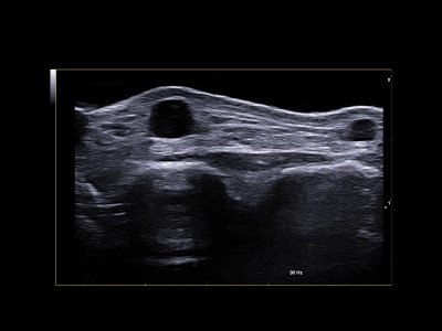 B-Mode MSK