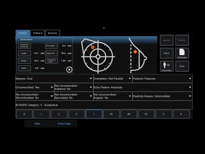 Tehnologija Breast Interactive Workflow