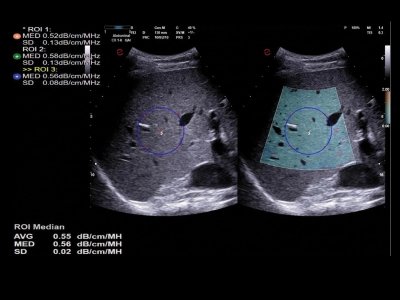 Jetra s tehnologijo QAI