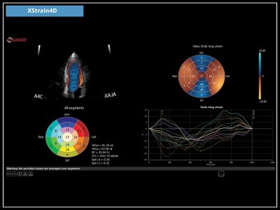 XStrain4D