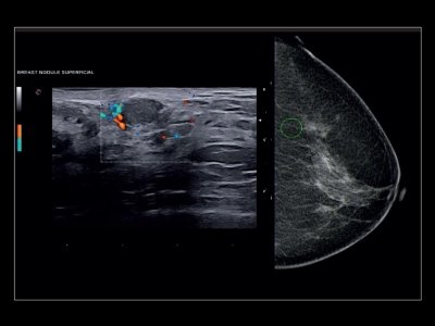 Multimodalna diagnostika s FollowUp