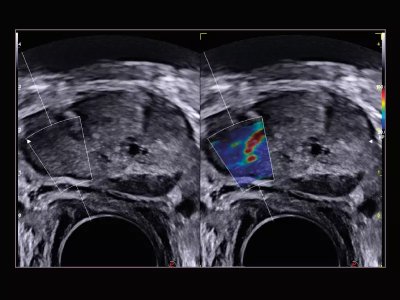 Urologija