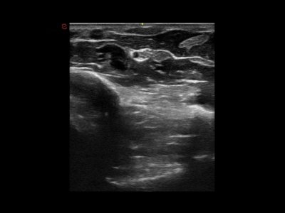 Abdominalno