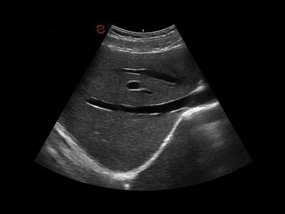 Abdominalno