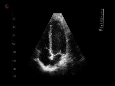 Kardiovaskularno Cardio B mode